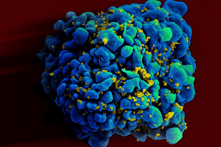 Il virus dell' HIV