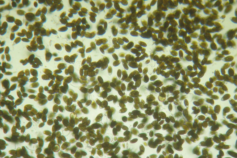 Alga tossica al microscopio fonte Nicola Ungaro. <span>Foto Nicola Ungaro</span>