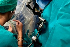 Neurochirurgia pediatrica, rimosso al Policlinico di Bari tumore al cervello di un ragazzo di 12 anni