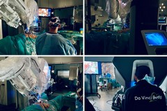 Chirurgia robotica al Policlinico di Bari: in funzione il nuovo robot "Da Vinci Single Port"