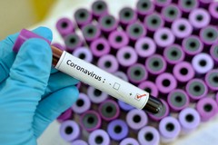 Coronavirus, positivo un agente di polizia locale ad Altamura