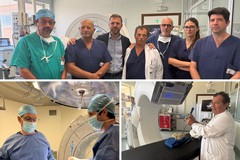 Neurochirurgia al Di Venere, in funzione la nuova piattaforma con neuronavigatore e immagini 3D