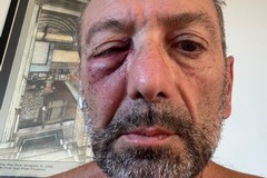 Runner colpito all'occhio da un uovo scagliato da un'auto