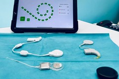 Restituito l'udito a un bambino di 11 grazie al primo impianto cocleare smart al Policlinico di Bari