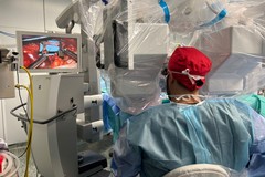 Trapianto di linfonodi con tecnica robotica al Policlinico di Bari. Il primo al Sud Italia