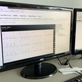 Policlinico di Bari, arrivano gli elettrocardiografi wi-fi per le diagnosi a distanza