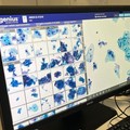 Tumore collo dell’utero, con l’IA qualità e velocità di diagnosi: da ASL Bari diagnostica citologica digitale