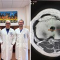 Policlinico di Bari, trapianto meniscale da donatore eseguito per la prima volta nel Sud Italia
