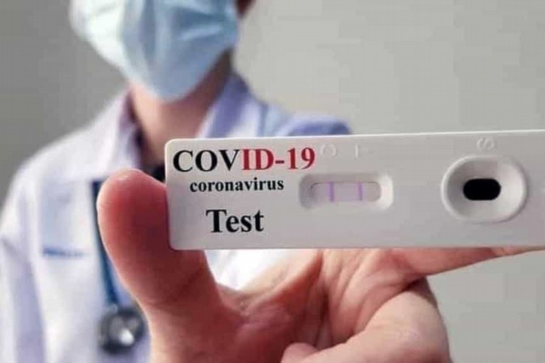 test sierologico coronavirus covid